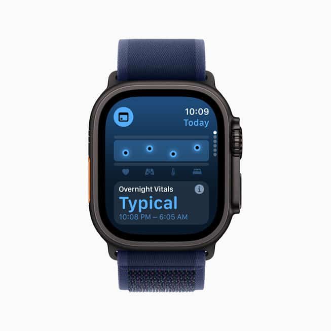 watchOS 11